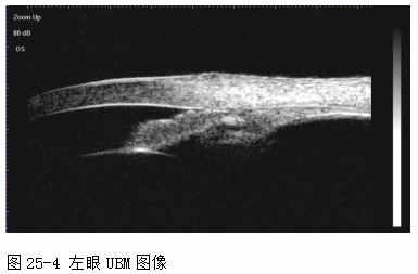 ZY016_130_4.gif